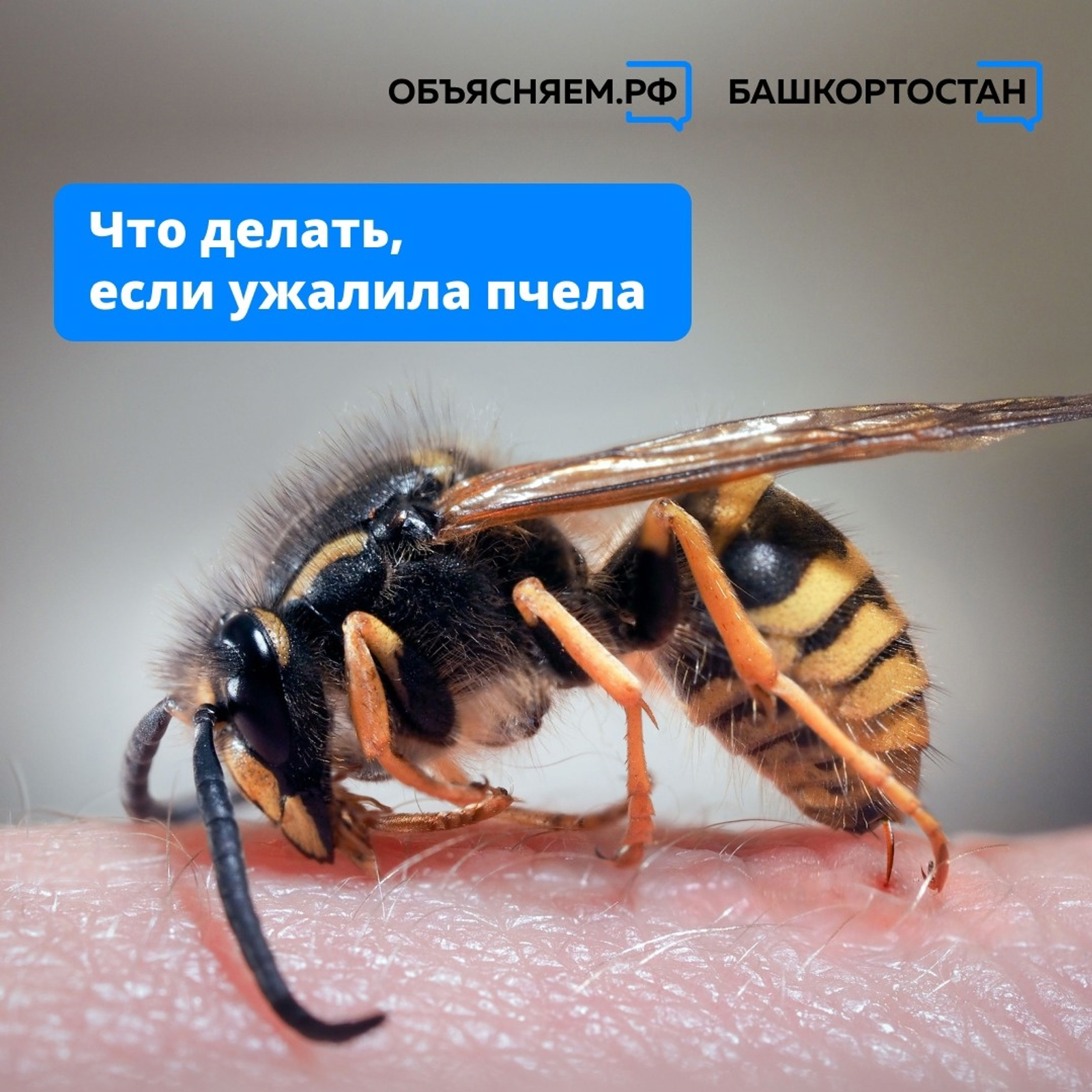 Что делать, если ужалила пчела